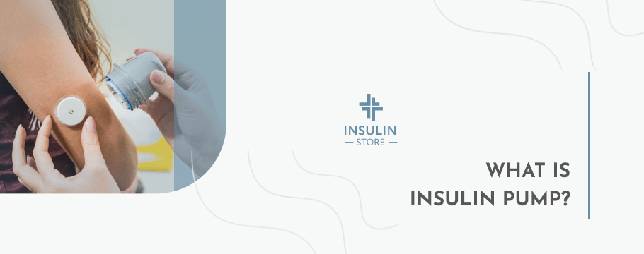 Insulin Pump: What It Is & How Does It Work?