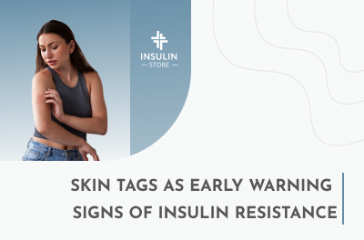 Skin Tags and Insulin Resistance