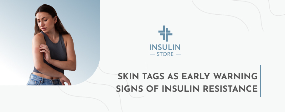 Skin Tags as Early Warning Signs of Insulin Resistance
